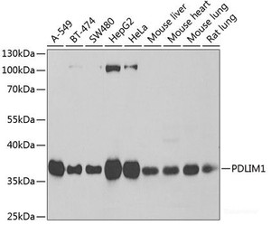 Western blot analysis of extracts of various cell lines using PDLIM1 Polyclonal Antibody at dilution of 1:1000.