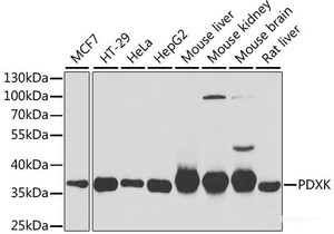 Western blot analysis of extracts of various cell lines using PDXK Polyclonal Antibody at dilution of 1:1000.