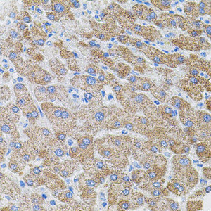 Immunohistochemistry of paraffin-embedded Human liver damage using PIK3CG Polyclonal Antibody