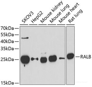 Western blot analysis of extracts of various cell lines using RALB Polyclonal Antibody at dilution of 1:1000.