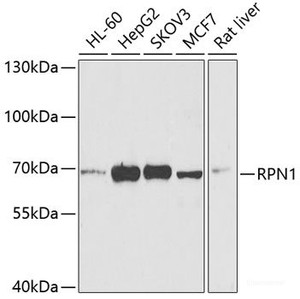 Western blot analysis of extracts of various cell lines using RPN1 Polyclonal Antibody at dilution of 1:1000.