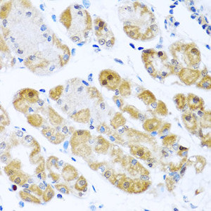 Immunohistochemistry of paraffin-embedded Human stomach using RPS2 Polyclonal Antibody at dilution of 1:100 (40x lens) .