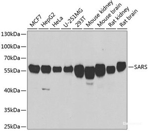 Western blot analysis of extracts of various cell lines using SARS Polyclonal Antibody at dilution of 1:1000.