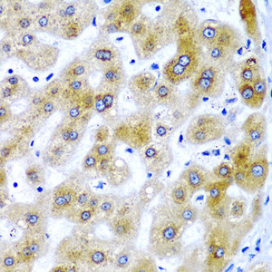 Immunohistochemistry of paraffin-embedded Human liver damage using SECISBP2 Polyclonal Antibody at dilution of 1:200 (40x lens) .