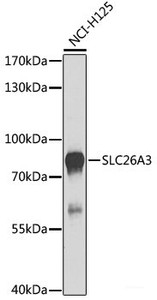 Western blot analysis of extracts of NCI-H125 cells using SLC26A3 Polyclonal Antibody at dilution of 1:1000.