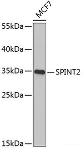 Western blot analysis of extracts of MCF-7 cells using SPINT2 Polyclonal Antibody at dilution of 1:1000.