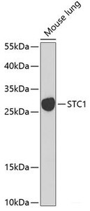 Western blot analysis of extracts of Mouse lung using STC1 Polyclonal Antibody at dilution of 1:1000.