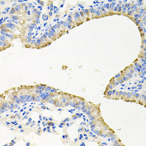 Immunohistochemistry of paraffin-embedded Mouse lung using STRN3 Polyclonal Antibody at dilution of 1:100 (40x lens) .