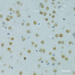 Immunohistochemistry of paraffin-embedded Rat brain using MUS81 Polyclonal Antibody at dilution of 1:100 (40x lens) .