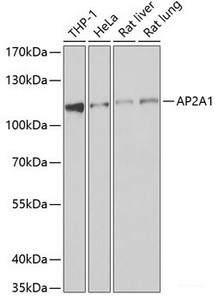 Western blot analysis of extracts of various cell lines using AP2A1 Polyclonal Antibody at dilution of 1:1000.