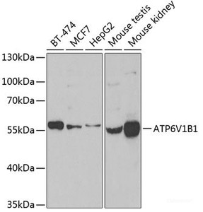 Western blot analysis of extracts of various cell lines using ATP6V1B1 Polyclonal Antibody at dilution of 1:1000.