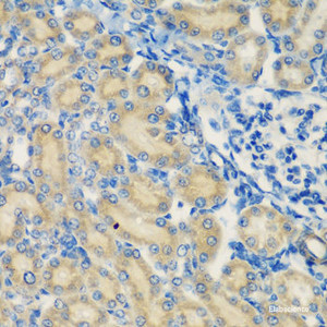 Immunohistochemistry of paraffin-embedded Rat kidney using C1S Polyclonal Antibody at dilution of 1:200 (40x lens) .