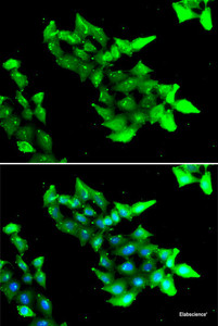 Immunofluorescence analysis of HeLa cells using KRIT1 Polyclonal Antibody
