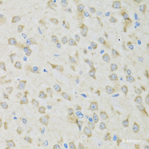 Immunohistochemistry of paraffin-embedded Mouse brain using CLCN7 Polyclonal Antibody at dilution of 1:100 (40x lens) .