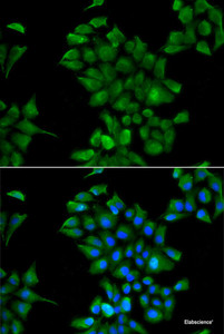Immunofluorescence analysis of HeLa cells using CTNS Polyclonal Antibody