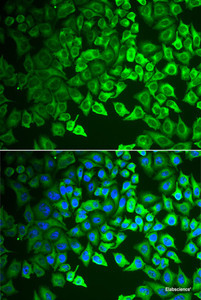 Immunofluorescence analysis of A549 cells using GIF Polyclonal Antibody