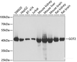 Western blot analysis of extracts of various cell lines using GOT2 Polyclonal Antibody at dilution of 1:1000.