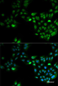 Immunofluorescence analysis of MCF7 cells using HOXA1 Polyclonal Antibody