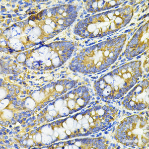 Immunohistochemistry of paraffin-embedded Rat intestine using HPGD Polyclonal Antibody at dilution of 1:100 (40x lens) .