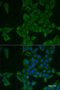 Immunofluorescence analysis of MCF7 cells using LGALS3BP Polyclonal Antibody