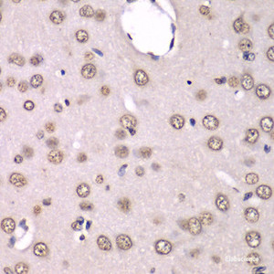 Immunohistochemistry of paraffin-embedded Rat brain using HNRNPM Polyclonal Antibody at dilution of 1:100 (40x lens) .