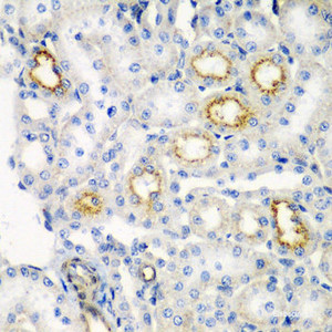 Immunohistochemistry of paraffin-embedded Rat kidney using RARRES2 Polyclonal Antibody at dilution of 1:200 (40x lens) .