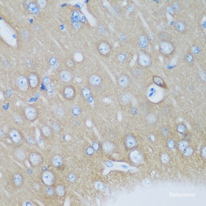 Immunohistochemistry of paraffin-embedded Mouse brain using VSNL1 Polyclonal Antibody at dilution of 1:200 (40x lens) .
