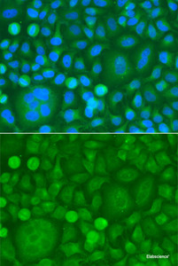 Immunofluorescence analysis of HeLa cells using EPM2A Polyclonal Antibody