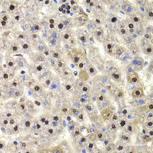 Immunohistochemistry of paraffin-embedded Rat liver using HIRIP3 Polyclonal Antibody at dilution of 1:100 (40x lens) .