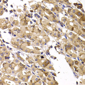 Immunohistochemistry of paraffin-embedded Human gastric damage using ASMTL Polyclonal Antibody at dilution of 1:100 (40x lens) .