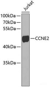 Western blot analysis of extracts of Jurkat cells using CCNE2 Polyclonal Antibody.