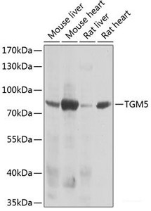 Western blot analysis of extracts of various cell lines using TGM5 Polyclonal Antibody at dilution of 1:1000.