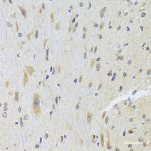 Immunohistochemistry of paraffin-embedded Rat spinal cord using DPP3 Polyclonal Antibody at dilution of 1:100 (40x lens) .