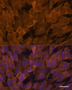 Immunofluorescence analysis of C6 cells using STAM2 Polyclonal Antibody at dilution of 1:100. Blue: DAPI for nuclear staining.