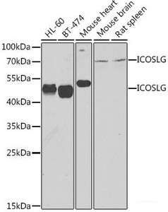 Western blot analysis of extracts of various cell lines using ICOSL Polyclonal Antibody at dilution of 1:1000.