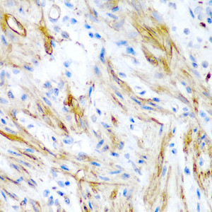 Immunohistochemistry of paraffin-embedded Human colon using LMOD1 Polyclonal Antibody at dilution of 1:200 (40x lens) .