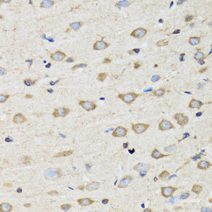 Immunohistochemistry of paraffin-embedded Rat brain using CLIC4 Polyclonal Antibody at dilution of 1:100 (40x lens) .