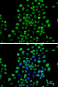 Immunofluorescence analysis of A-549 cells using NTMT1 Polyclonal Antibody