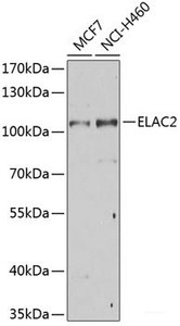 Western blot analysis of extracts of various cell lines using ELAC2 Polyclonal Antibody at dilution of 1:1000.