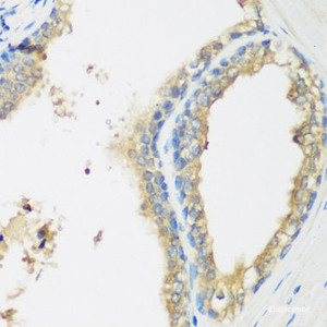 Immunohistochemistry of paraffin-embedded Human prostate using WDR77 Polyclonal Antibody at dilution of 1:200 (40x lens) .