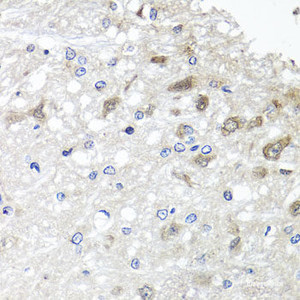 Immunohistochemistry of paraffin-embedded Rat brain using METTL20 Polyclonal Antibody at dilution of 1:100 (40x lens) .