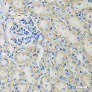 Immunohistochemistry of paraffin-embedded Rat kidney using CCL26 Polyclonal Antibody at dilution of 1:200 (40x lens) .