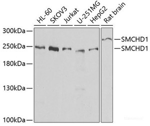 Western blot analysis of extracts of various cell lines using SMCHD1 Polyclonal Antibody at dilution of 1:1000.