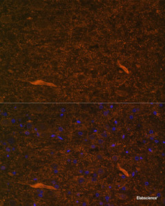 Immunofluorescence analysis of Rat brain using TEK Polyclonal Antibody at dilution of 1:100. Blue: DAPI for nuclear staining.