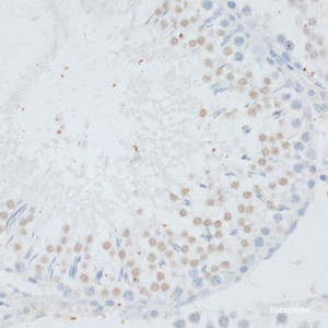 Immunohistochemistry of paraffin-embedded Rat testis using DNMT3B Polyclonal Antibody at dilution of 1:100 (40x lens) .