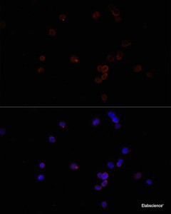 Immunofluorescence analysis of Jurkat cells using CD47 Polyclonal Antibody at dilution of 1:100. Blue: DAPI for nuclear staining.