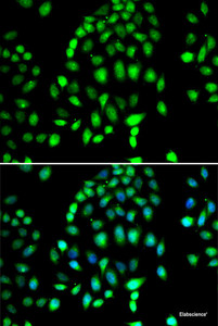 Immunofluorescence analysis of MCF-7 cells using PARP3 Polyclonal Antibody