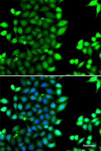 Immunofluorescence analysis of MCF-7 cells using RNF7 Polyclonal Antibody