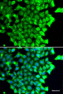 Immunofluorescence analysis of MCF-7 cells using TRIAP1 Polyclonal Antibody