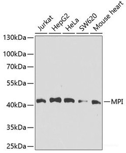 Western blot analysis of extracts of various cell lines using MPI Polyclonal Antibody at dilution of 1:1000.